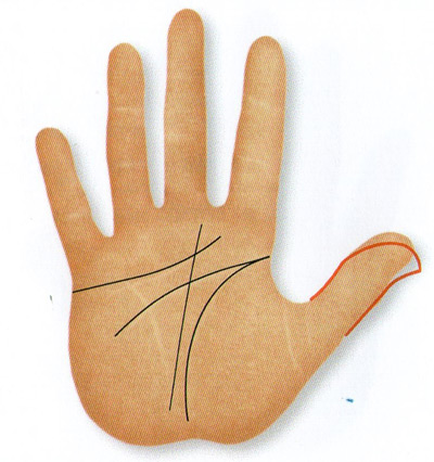 nail phalange bent